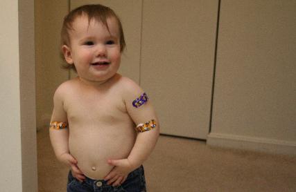 Brave little girl...  She got a shot, and blood drawn out of each arm.  Here she is sporting her array of band-aids.